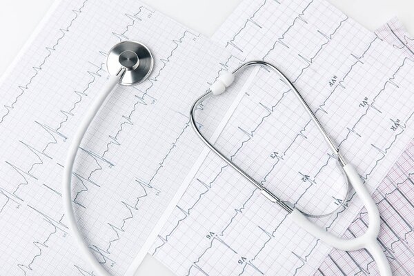 听诊器放置在纸上, 心电图在白色背景上隔离     图片素材